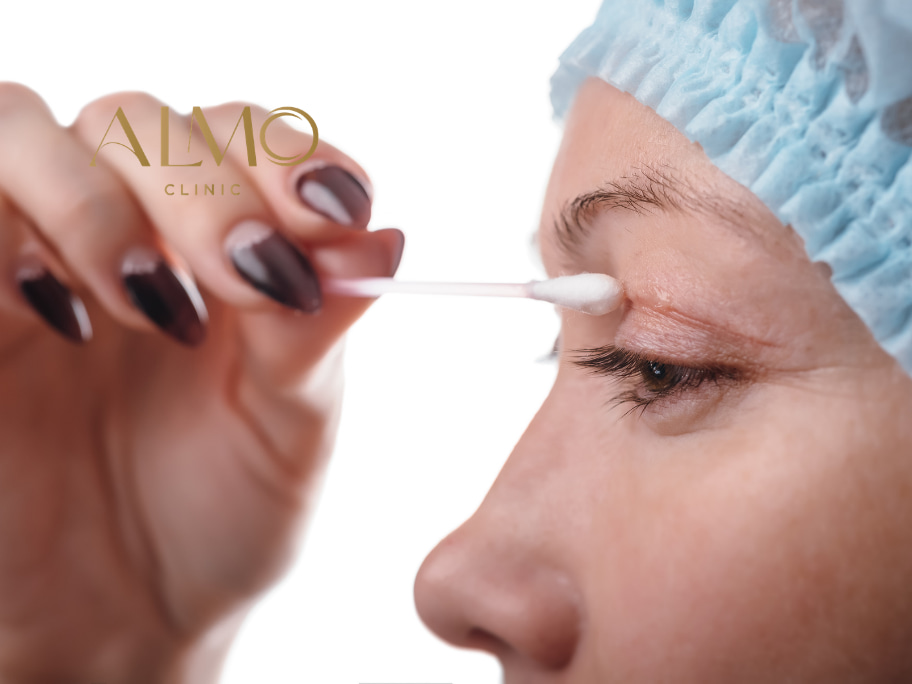 Recuperación de blefaroplastia en Bogotá — evolución postoperatoria ALMO Clinic