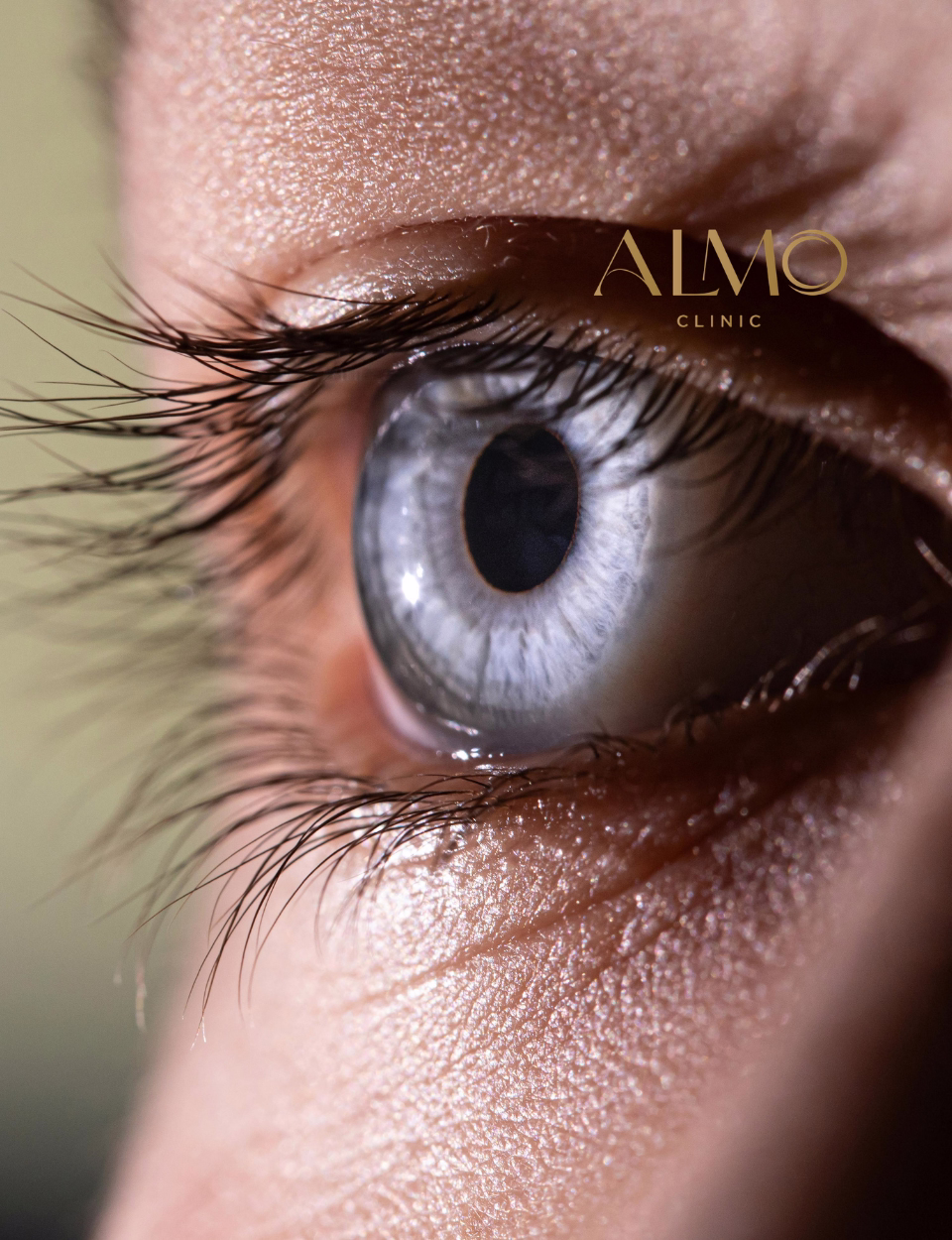Blefaroplastia con láser CO2 en Bogotá — técnica de incisión en pliegue palpebral para resultado natural ALMO Clinic