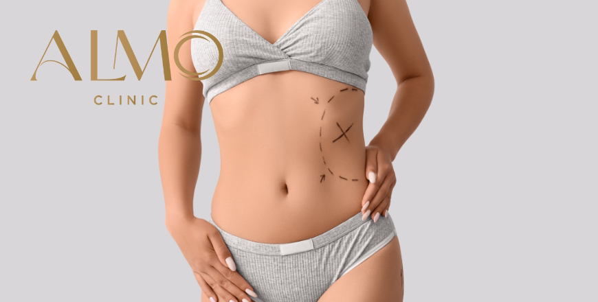 Abdominoplasty: open wounds — guide & care