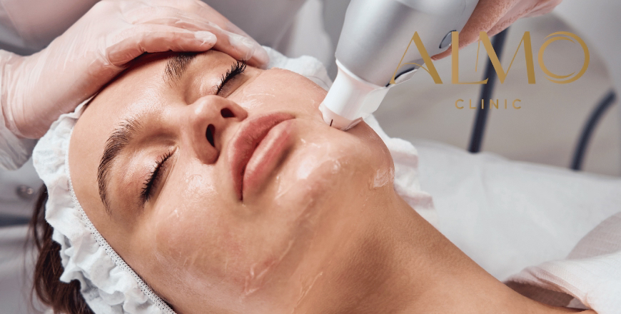 Antes y después Liftera vs Ultherapy