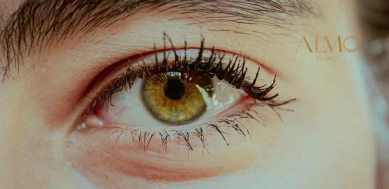 Types of blepharoplasty: upper for drooping lid and lower for fat bags — ALMO Clinic Bogotá Upper and lower blepharoplasty — types of eyelid surgery in Bogotá ALMO Clinic