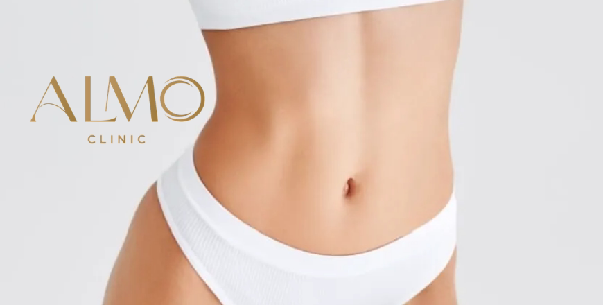 BodyTite: incisiones de 4mm, recuperación 5-7 días vs Abdominoplastia: cicatriz 30cm, recuperación 4-6 semanas Comparativa BodyTite abdomen vs abdominoplastia