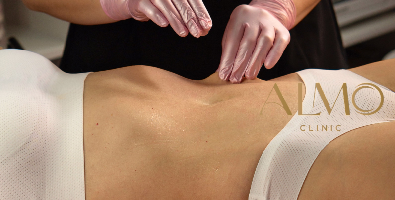 Tecnología BodyTite para abdomen
