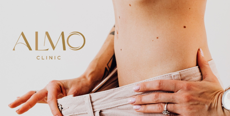 BodyTite abdomen vs abdominoplastia Bogotá 2026: cuál elegir | ALMO Clinic