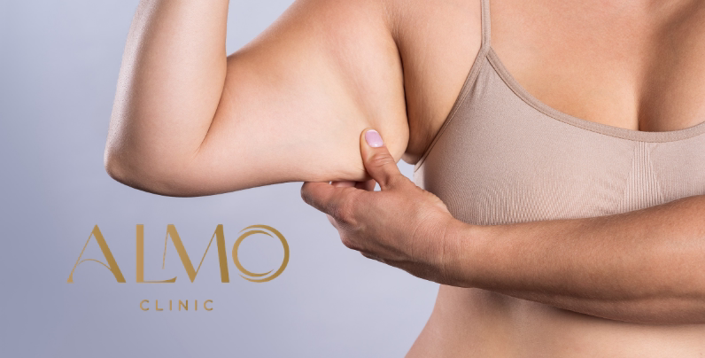 Ideal candidates for BodyTite arms