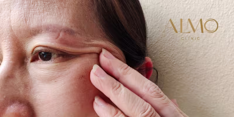 The 5 Botox complications I see every month in my practice