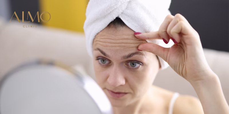 Early wrinkles at 30: when dermatologists say you should actually worry