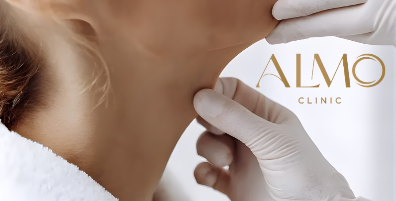 Moderate-severe double chin, mild-moderate cervical sagging, elastic skin Ideal candidates for FaceTite