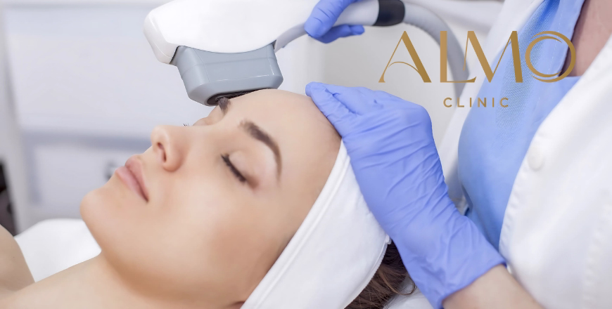 Profundidades HIFU con Liftera