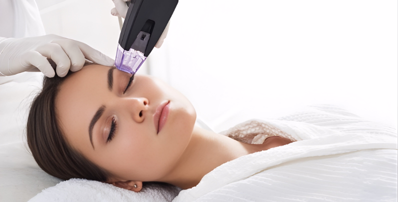 Morpheus8 vs Thermage: comparación tratamientos faciales Bogotá Morpheus8 vs Thermage: comparación tratamientos faciales Bogotá