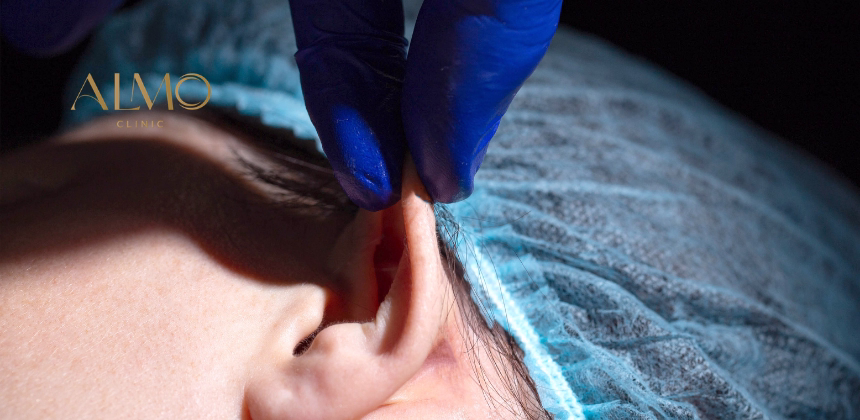 Otoplastia sin Cirugía: Qué Alternativas Funcionan y Cuándo Hay que Operar
