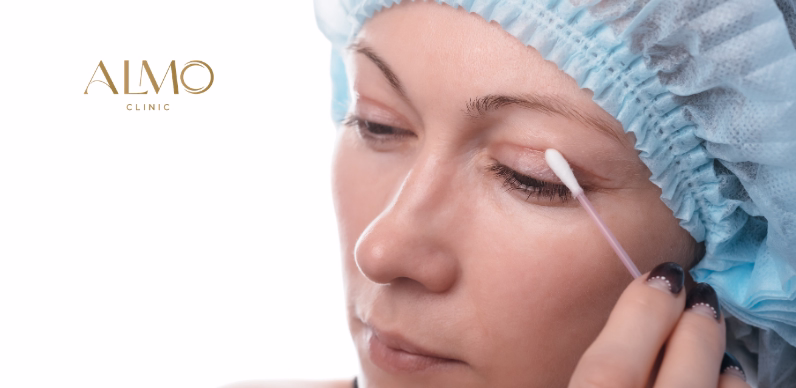 Drooping eyelids and permanently tired appearance — sign you need blepharoplasty in Bogotá ALMO Clinic
