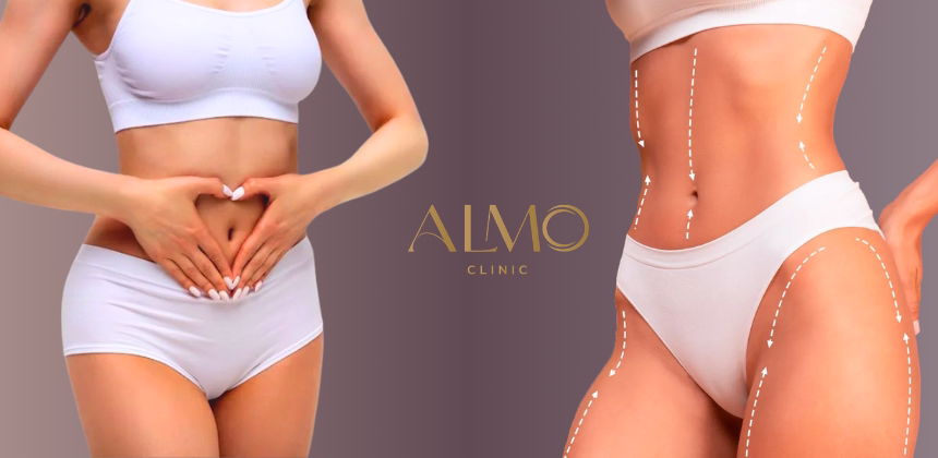 Timeline de planificación por etapas cirugía postbariátrica etapa 1 abdominoplastia etapa 2 extremidades separación 3-6 meses