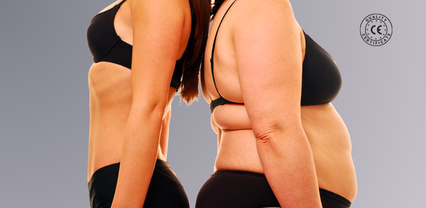 Diagrama corporal mostrando zonas de piel excedente después de pérdida masiva de peso brazos abdomen muslos senos