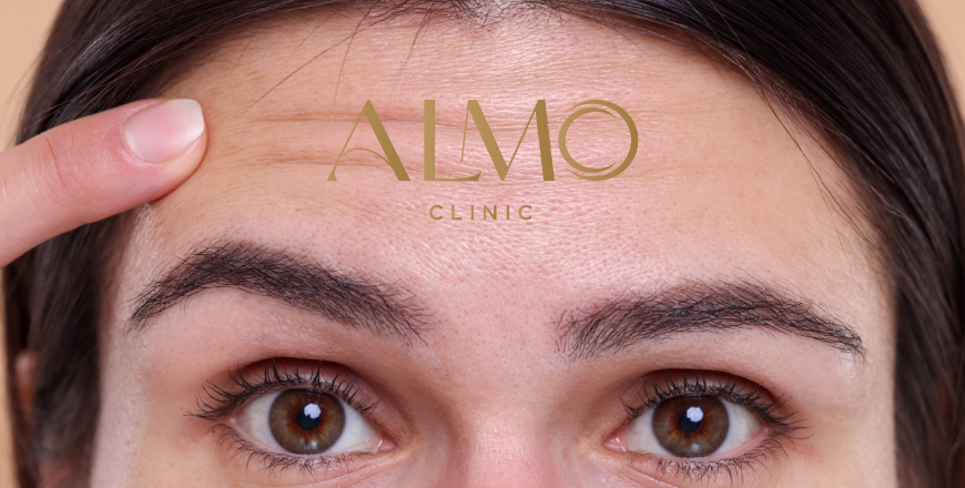 First wrinkles at 30: prevention & dermatologist-backed routine
