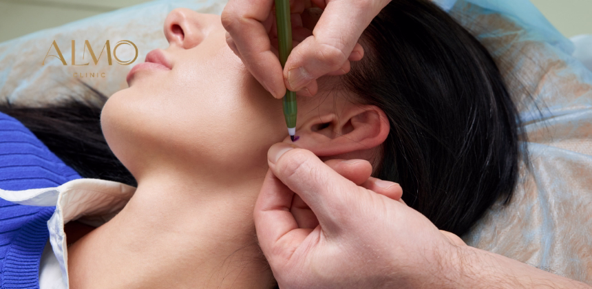 ¿Qué es la Otoplastia? La Cirugía que Corrige las Orejas de Soplillo