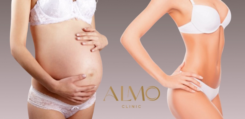 What Is a Mommy Makeover? Complete Medical Guide 2026