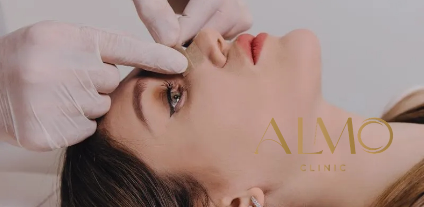 Rhinoplasty for men in Bogotá — masculine aesthetic parameters and natural result Male rhinoplasty — aesthetic parameters and natural result in Bogotá
