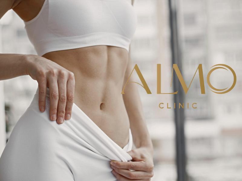 Tratamiento BodyTite con radiofrecuencia RFAL en ALMO Clinic Bogotá