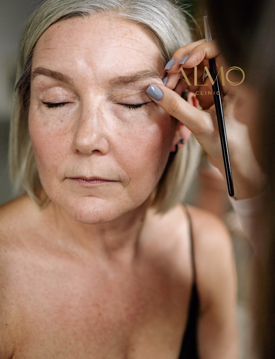 Cuidados postoperatorios blefaroplastia en Bogotá — evolución cicatrices párpados y protección solar ALMO Clinic