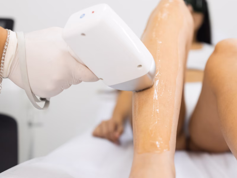 Depilación láser diodo en ALMO Clinic