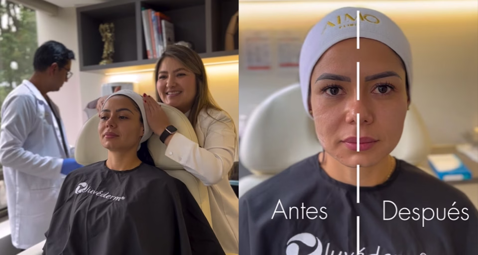 Medical and aesthetic dermatological treatments at ALMO Clinic