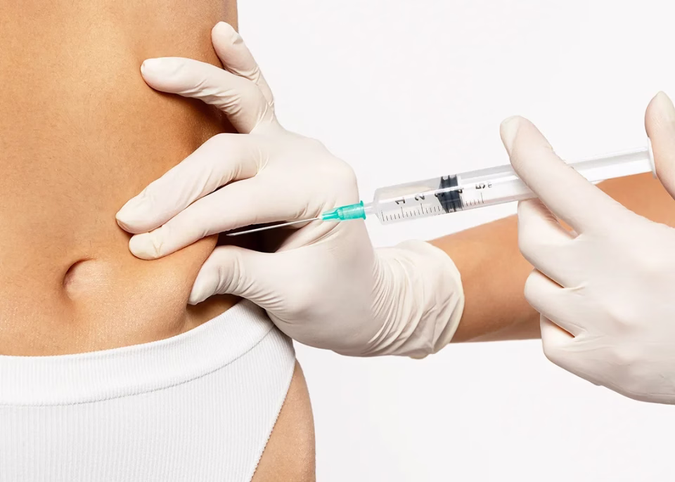 Tratamiento con hilos tensores en ALMO Clinic