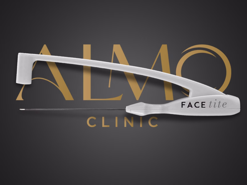 FaceTite radiofrequency-assisted device used at ALMO Clinic