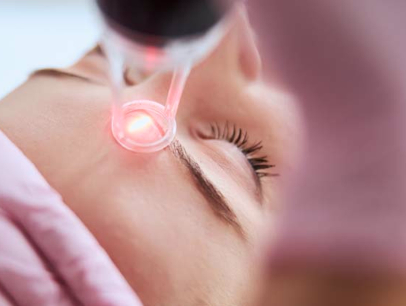 Fractional CO2 laser device applied near the eye contour