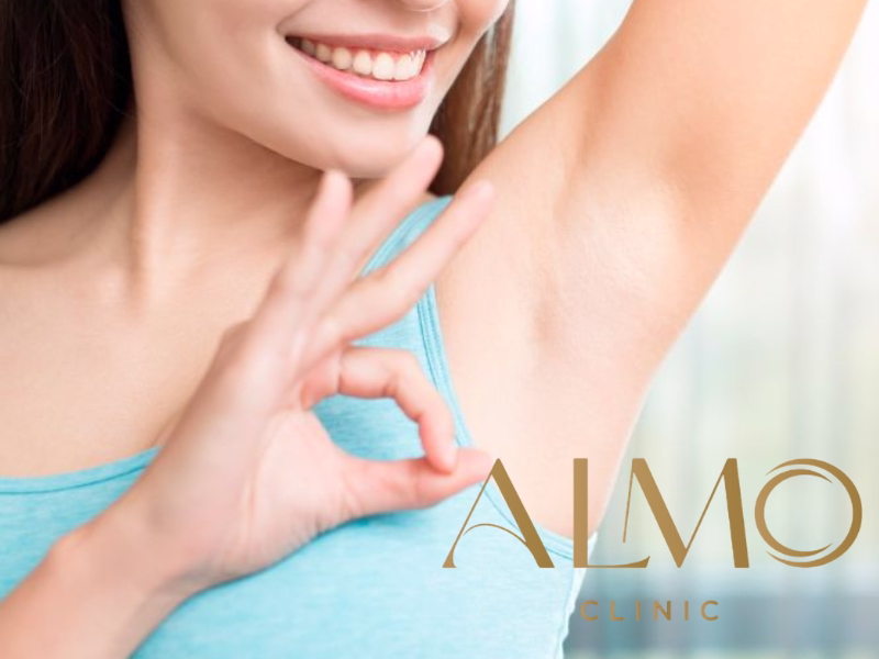 Tratamiento hiperhidrosis axilar con Morpheus8 en Bogotá