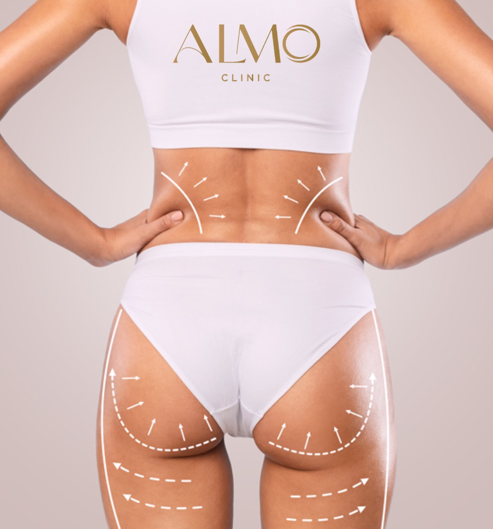 Ciencia detrás Morpheus8 Body