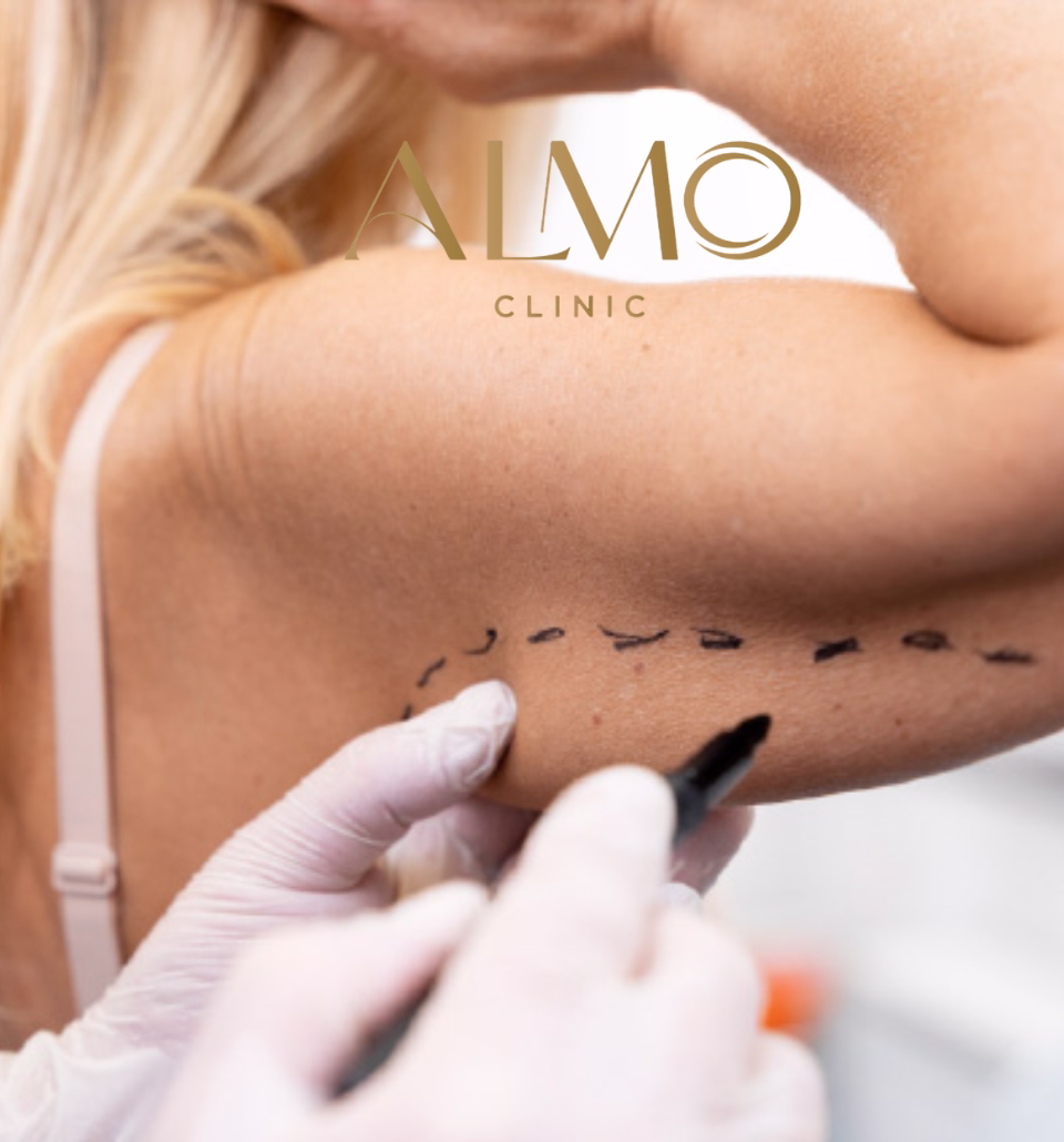 Paciente en consulta de valoración para cirugía de brazos