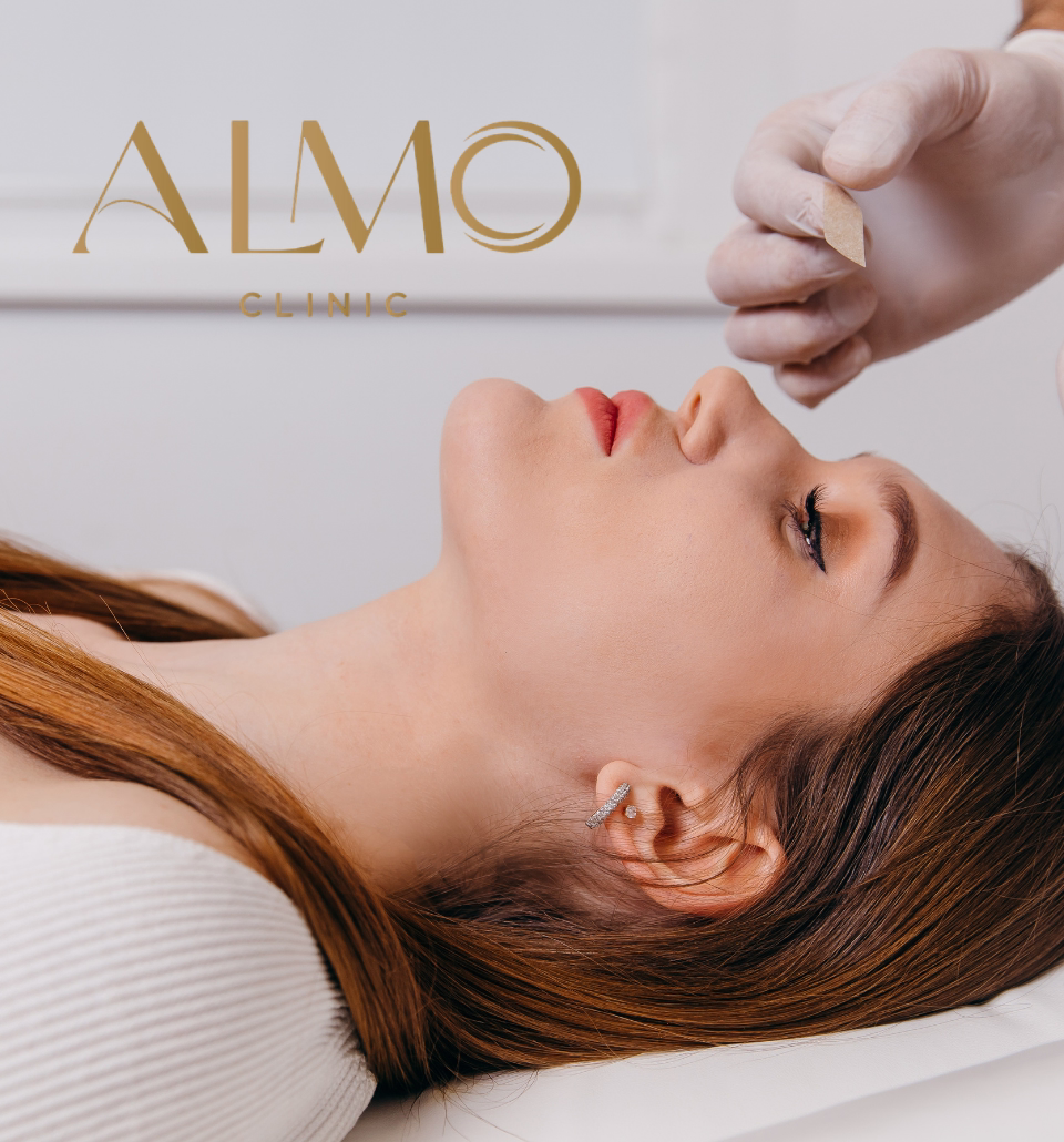 Rhinoplasty postoperative care — natural result in ALMO Clinic Bogotá