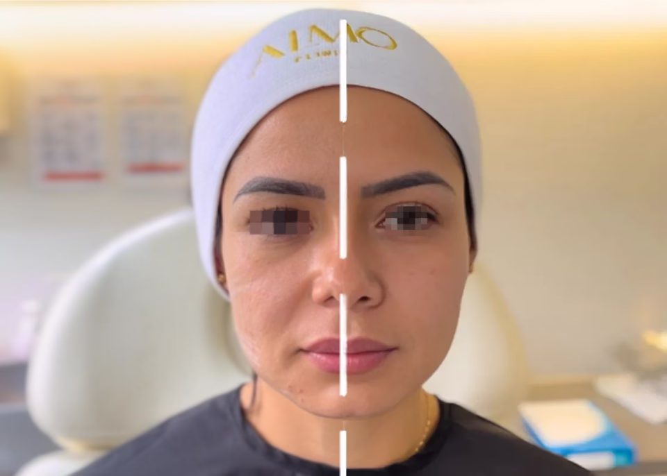 Dermatología para pacientes internacionales en ALMO Clinic
